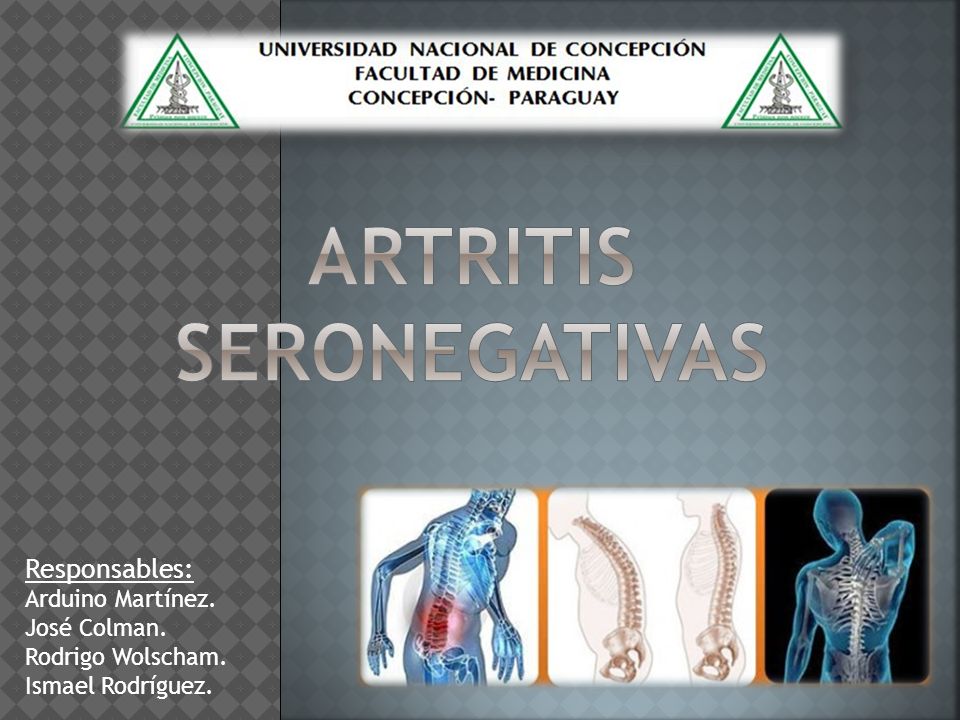 artritis reumatoide seronegativa sintomas artritis reumatoide seronegativa sintomas